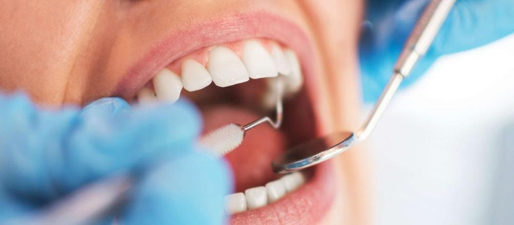 Boca sendo examinada no dentista