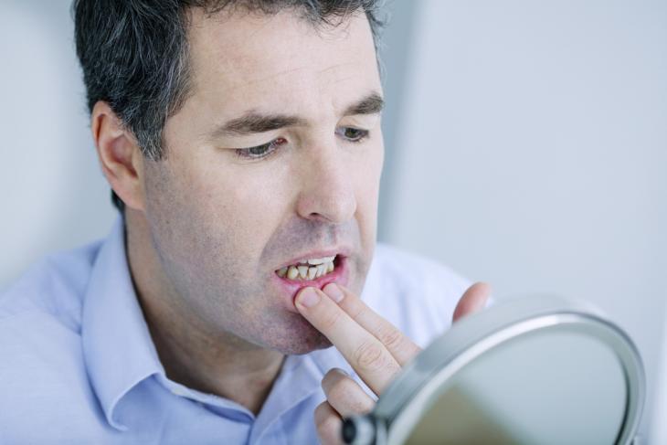 Imagem de um homem preocupado olhando no espelho e tocando um dente quebrado, indicando a necessidade de cuidados odontológicos