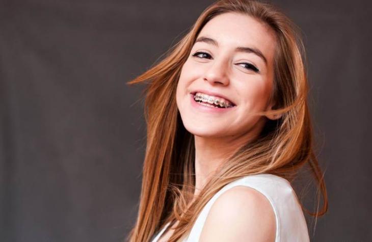 Imagem de mulher jovem sorrindo com aparelho dentário, reforçando que não é recomendado tirar a borrachinha do aparelho em casa