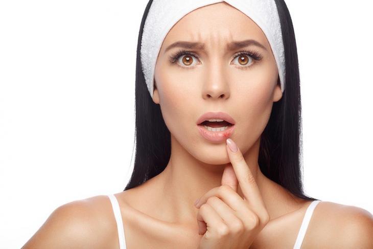 Imagem de uma mulher preocupada tocando os lábios, indicando possíveis sintomas de herpes labial