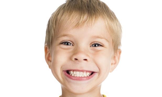 Imagem de um menino sorrindo, conscientizando que a cárie pode ser mais comum em crianças e idosos